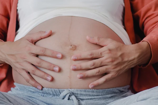 Caesarean Section